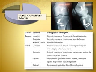 “TUNEL MALPOSITION”
Value 75%
Technical error
 