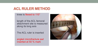 Acl reconstruction | PPTX