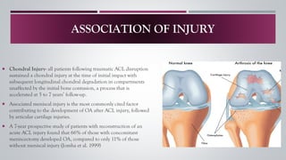 Subsequent Injury ACL INJURY A–Z: From Non-Operative Treatment to Post-Surgical Rehab | PDF