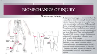 ACL INJURY A–Z: From Non-Operative Treatment to Post-Surgical Rehab | PDF