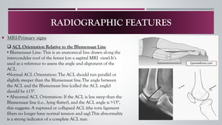 ACL INJURY A–Z: From Non-Operative Treatment to Post-Surgical Rehab | PDF