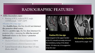 ACL INJURY A–Z: From Non-Operative Treatment to Post-Surgical Rehab | PDF