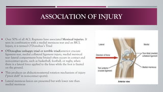 ACL INJURY A–Z: From Non-Operative Treatment to Post-Surgical Rehab | PDF