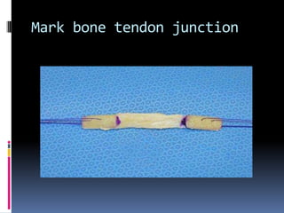 Mark bone tendon junction

 