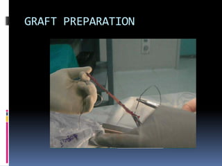 GRAFT PREPARATION

 