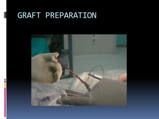GRAFT PREPARATION

 