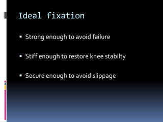 Ideal fixation
 Strong enough to avoid failure
 Stiff enough to restore knee stabilty
 Secure enough to avoid slippage

 