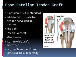 Bone-Patellar Tendon Graft
 Considered GOLD standard
 Middle third of patellar

tendon harvested(1011mm)
 Incision
-Medial Vertical
-Transverse
 10 mm wide graft
harvested
 2.5 mm bone plug from
patella & Tibial tuberosity

 