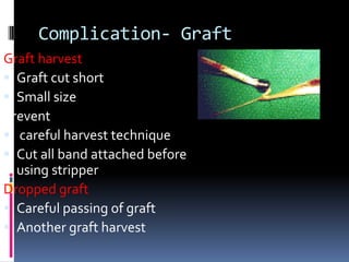 Complication- Graft
Graft harvest
 Graft cut short
 Small size
Prevent
 careful harvest technique
 Cut all band attached before
using stripper
Dropped graft
 Careful passing of graft
 Another graft harvest

 