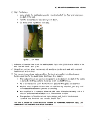 ACL Reconstruction Rehabilitation Protocol


2) Start Toe Raises.
       •   Using a table for stabilization, gently raise the heel off the floor and balance on
           the ball of the feet.
       •   Hold for 6 seconds and ease slowly back down.
       •   Do 3 sets of 10 repetitions each day.




              Figure 11. Toe Raise


3) Continue to use the knee brace for walking even if you have good muscle control of the
   leg. This will protect your graft.
4) Wean from crutches when you can put full weight on the leg and walk with a normal
   heal-toe gait and no limp.
5) You can continue using a stationary bike. Cycling is an excellent conditioning and
   building exercise for the quadriceps. See Figure 6 on page 6.
       •   The seat position is set so when the pedal is at the bottom, the ball of the foot is
           in contact with the pedal and there is a slight bend at the knee.
       •   No or low resistance used. Maintain good posture throughout the exercise.
       •   As your ability to pedal the bike with the operative leg improves, you may start
           to increase the resistance (around 5-6 weeks).
       •   Your objective is to slowly increase the time spent on the bike starting first at 5
           minutes and eventually working up to 20 minutes a session.
       •   The resistance of the bike should be increased such that by the time you
           complete your work-out your muscles should "burn".

   THE BIKE IS ONE OF THE SAFEST MACHINES YOU CAN USE TO REHABILITATE YOUR KNEE, AND
   THERE IS NO LIMITATION ON HOW MUCH YOU USE IT.




                                              - 14 -
 