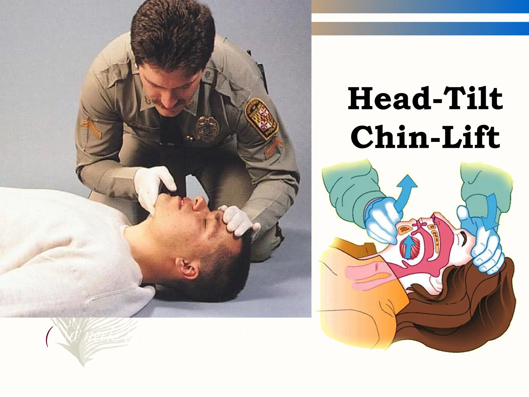 Head-Tilt
Chin-Lift
(No neck injury suspected)
 