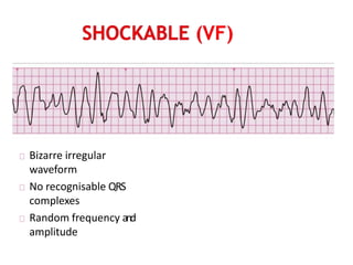 Advanced Cardiovascular Life Support | PPTX