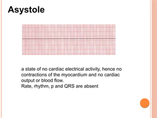 Acls advanced cardiac life support | PPTX