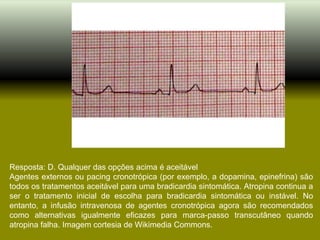 Resposta: D. Qualquer das opções acima é aceitável
Agentes externos ou pacing cronotrópica (por exemplo, a dopamina, epinefrina) são
todos os tratamentos aceitável para uma bradicardia sintomática. Atropina continua a
ser o tratamento inicial de escolha para bradicardia sintomática ou instável. No
entanto, a infusão intravenosa de agentes cronotrópica agora são recomendados
como alternativas igualmente eficazes para marca-passo transcutâneo quando
atropina falha. Imagem cortesia de Wikimedia Commons.
 