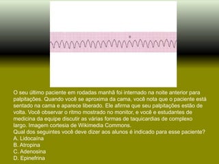 O seu último paciente em rodadas manhã foi internado na noite anterior para
palpitações. Quando você se aproxima da cama, você nota que o paciente está
sentado na cama e aparece liberado. Ele afirma que seu palpitações estão de
volta. Você observar o ritmo mostrado no monitor, e você e estudantes de
medicina da equipe discutir as várias formas de taquicardias de complexo
largo. Imagem cortesia de Wikimedia Commons.
Qual dos seguintes você deve dizer aos alunos é indicado para esse paciente?
A. Lidocaína
B. Atropina
C. Adenosina
D. Epinefrina
 