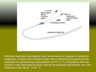 Melhores resultados neurológicos foram encontrados em resposta a hipotermia
terapêutica. A maioria dos estudos iniciais sobre a hipotermia terapêutica foram
realizados em pacientes que apresentaram em FV ou TV. A hipotermia deve ser
iniciado o mais cedo possível após o retorno da circulação espontânea, com uma
temperatura alvo de 32 ° C-34 ° C.
 