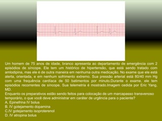 Um homem de 75 anos de idade, branco apresenta ao departamento de emergência com 2
episódios de síncope. Ele tem um histórico de hipertensão, que está sendo tratado com
amlodipina, mas ele é de outra maneira em nenhuma outra medicação. No exame que ele está
alerta, orientada, e em nenhum sofrimento extremo. Sua pressão arterial está 80/40 mm Hg
com uma frequência cardíaca de 50 batimentos por minuto.Durante o exame, ele tem
episódios recorrentes de síncope. Sua telemetria é mostrado.Imagem cedida por Eric Yang,
MD.
Enquanto os preparativos estão sendo feitos para colocação de um marcapasso transvenoso
temporário, o que você deve administrar em caráter de urgência para o paciente?
A. Epinefrina IV bolus
B. IV gotejamento dopamina
C.IV gotejamento isoproterenol
D. IV atropina bolus
 