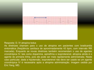 Resposta: D. IV atropina bolus
As diretrizes chamam para o uso de atropina em pacientes com bradicardia
sintomática (freqüência cardíaca de aproximadamente 43 bpm, com intervalo RR
marcada). Enquanto as novas diretrizes também recomendam o uso de agentes
cronotrópica IV, tais como dopamina, epinefrina e isoproterenol, atropina ainda é o
agente de primeira linha, pois ele pode ser mais rapidamente administrada. Neste
caso particular, dada a hipotensão, isoproterenol não deve ser usado se um agente
cronotrópica IV é necessária após a atropina administração. Imagem cedida por
Eric Yang, MD.
 