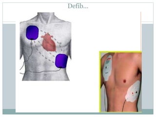 Adult cardiac life support(ACLS) | PPTX