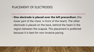 PLACEMENT OF ELECTRODES
• One electrode is placed over the left precordium (the
lower part of the chest, in front of the heart). The other
electrode is placed on the back, behind the heart in the
region between the scapula. This placement is preferred
because it is best for non-invasive pacing
 