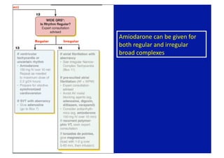 Amiodarone can be given for 
both regular and irregular 
broad complexes 
 