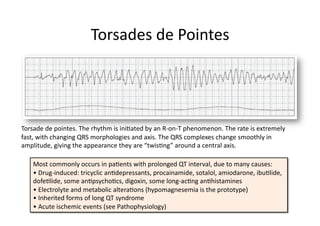 Torsades de Pointes 




Torsade de pointes. The rhythm is iniFated by an R‐on‐T phenomenon. The rate is extremely 
fast, with changing QRS morphologies and axis. The QRS complexes change smoothly in 
amplitude, giving the appearance they are “twisFng” around a central axis. 

   Most commonly occurs in paFents with prolonged QT interval, due to many causes: 
   • Drug‐induced: tricyclic anFdepressants, procainamide, sotalol, amiodarone, ibuFlide, 
   dofeFlide, some anFpsychoFcs, digoxin, some long‐acFng anFhistamines 
   • Electrolyte and metabolic alteraFons (hypomagnesemia is the prototype) 
   • Inherited forms of long QT syndrome 
   • Acute ischemic events (see Pathophysiology) 
 
