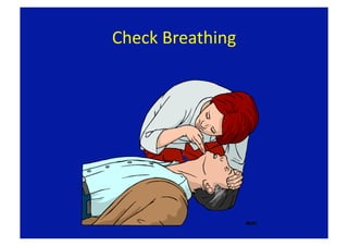 Check Breathing 
 