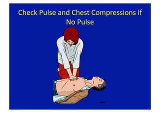 Check Pulse and Chest Compressions if 
              No Pulse 
 