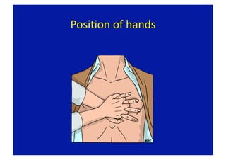 PosiFon of hands 
 
