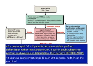 • For polymorphic VT – if paFents become unstable, perform 
deﬁbrillaFon rather than cardioversion. If ever in doubt whether to 
perform cardioversion or deﬁbrillaFon, then perform DEFIBRILLATION 
• If your eye cannot synchronize to each QRS complex, neither can the 
machine! 
 