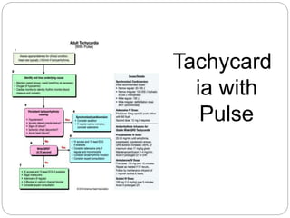 Tachycard
ia with
Pulse
 