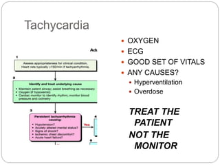 Tachycardia
 OXYGEN
 ECG
 GOOD SET OF VITALS
 ANY CAUSES?
 Hyperventilation
 Overdose
TREAT THE
PATIENT
NOT THE
MONITOR
 