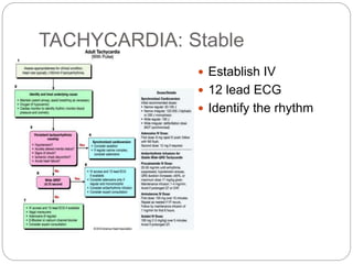 TACHYCARDIA: Stable
 Establish IV
 12 lead ECG
 Identify the rhythm
 