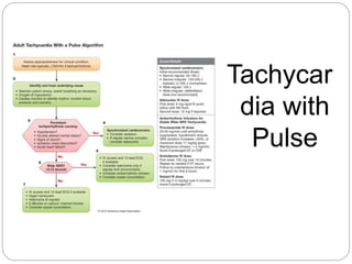 Tachycar
dia with
Pulse
 