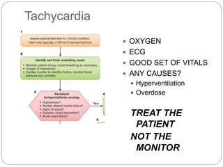 Tachycardia
 OXYGEN
 ECG
 GOOD SET OF VITALS
 ANY CAUSES?
 Hyperventilation
 Overdose
TREAT THE
PATIENT
NOT THE
MONITOR
 