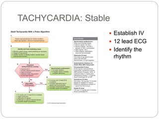 TACHYCARDIA: Stable
 Establish IV
 12 lead ECG
 Identify the
rhythm
 