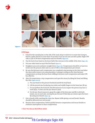 ACLS – Advanced Cardiac Life Support
12
CPR Steps
1.	 Check for the carotid pulse on the side of the neck. Keep in mind not to waste time trying to
feel for a pulse; feel for no more than 10 seconds. If you are not sure you feel a pulse, begin CPR
with a cycle of 30 chest compressions and two breaths (Figure 4a).
2.	 Use the heel of one hand on the lower half of the sternum in the middle of the chest (Figure 4b).
3.	 Put your other hand on top of the first hand (Figure 4c).
4.	 Straighten your arms and press straight down (Figure 4d). Compressions should be at least two
inches into the person’s chest and at a rate of 100 to 120 compressions per minute.
5.	 Be sure that between each compression you completely stop pressing on the chest and allow
the chest wall to return to its natural position. Leaning or resting on the chest between
compressions can keep the heart from refilling in between each compression and make CPR
less effective.
6.	 After 30 compressions, stop compressions and open the airway by tilting the head and lifting
the chin (Figure 4e  4f).
a.	 Put your hand on the person’s forehead and tilt the head back.
b.	 Lift the person’s jaw by placing your index and middle fingers on the lower jaw; lift up.
c.	 Do not perform the head-tilt-chin lift maneuver if you suspect the person may have a
neck injury. In that case the jaw-thrust is used.
d.	 For the jaw-thrust maneuver, grasp the angles of the lower jaw and lift it with both
hands, one on each side, moving the jaw forward. If their lips are closed, open the lower
lip using your thumb (Figure 4g).
7.	 Give a breath while watching the chest rise. Repeat while giving a second breath. Breaths
should be delivered over one second.
8.	 Resume chest compressions. Switch quickly between compressions and rescue breaths to
minimize interruptions in chest compressions.
 Next: Two-Rescuer BLS/CPR for Adults
Figure 4
A B C
D E F G
FB:Cardiologia Siglo XXI
 
