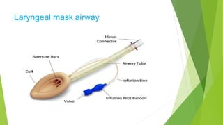 Laryngeal mask airway
 