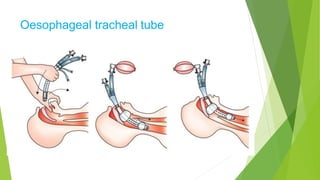 Oesophageal tracheal tube
 