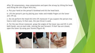 After 30 compressions, stop compressions and open the airway by tilting the head
and lifting the chin (Figure 4d & 4e).
a. Put your hand on the person’s forehead and tilt the head back.
b. Lift the person’s jaw by placing your index and middle fingers on the lower
jaw; lift up.
c. Do not perform the head-tilt/chin-lift maneuver if you suspect the person may
have a neck injury. In that case, the jaw-thrust is used.
d. For the jaw-thrust maneuver, grasp the angles of the lower jaw and lift it with
both hands, one on each side, moving the jaw forward. If their lips are closed,
open the lower lip using your thumb (Figure 4f)
 