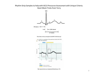 aclsCardiac_Dysrhythmia_Overview_to_help_with_ACLS_Precourse ...