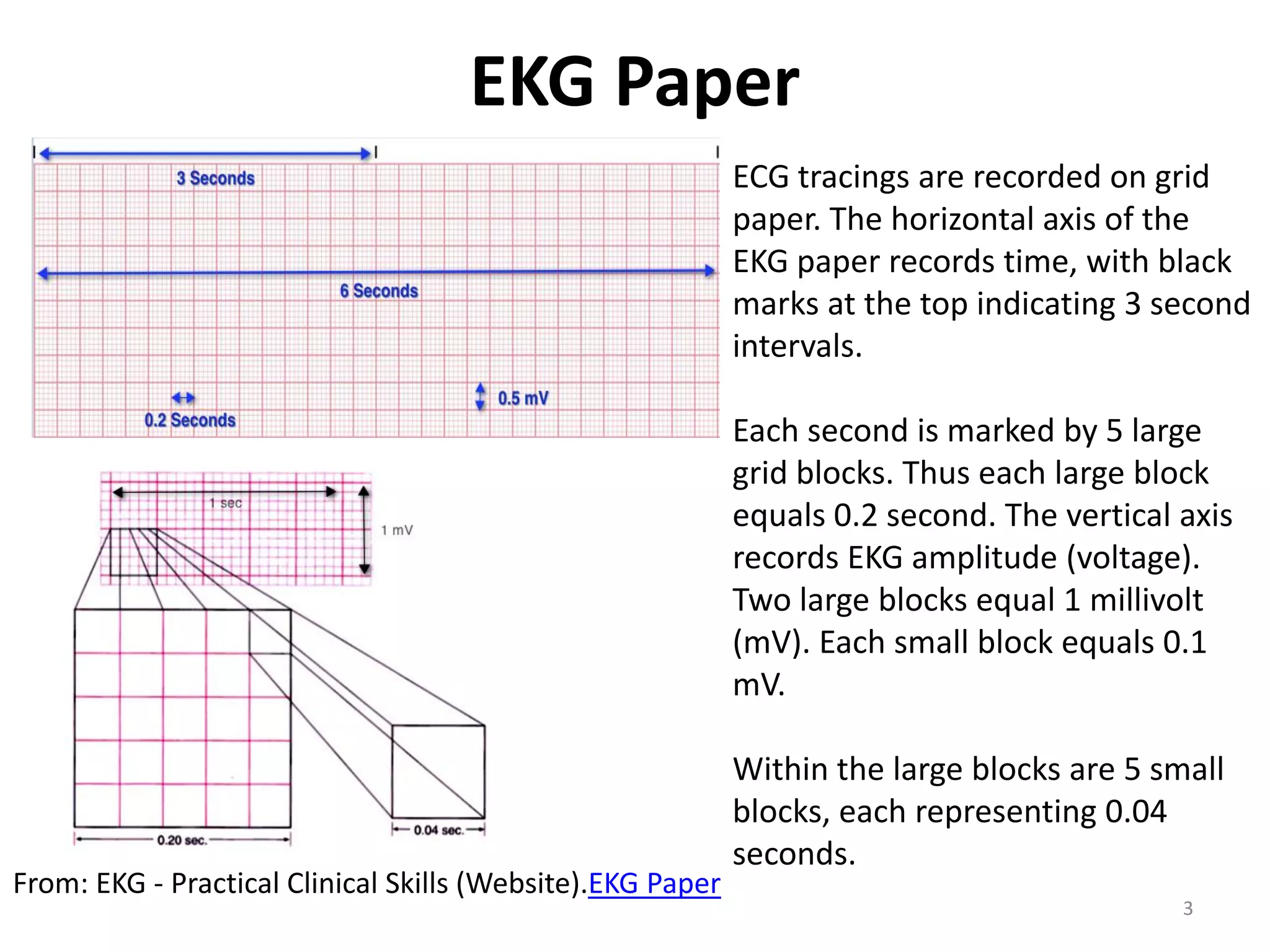 ACLS CE -Part I of III -ECG STRIP INTERPRETATION w Case Scenarios ...