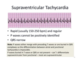 ACLS CE -Part I of III -ECG STRIP INTERPRETATION w Case Scenarios ...