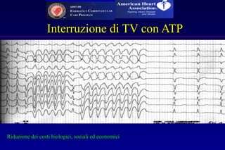 Interruzione di TV con ATPInterruzione di TV con ATP
Riduzione dei costi biologici, sociali ed economiciRiduzione dei costi biologici, sociali ed economici
 