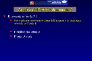 È presente un’onda P ?
 Molte aritmie sono caratterizzate dall’assenza o da un aspetto
anomalo dell’onda P.
 Fibrillazione Atriale
 Flutter Atriale
Analisi dell’ECG: domanda 2Analisi dell’ECG: domanda 2
 