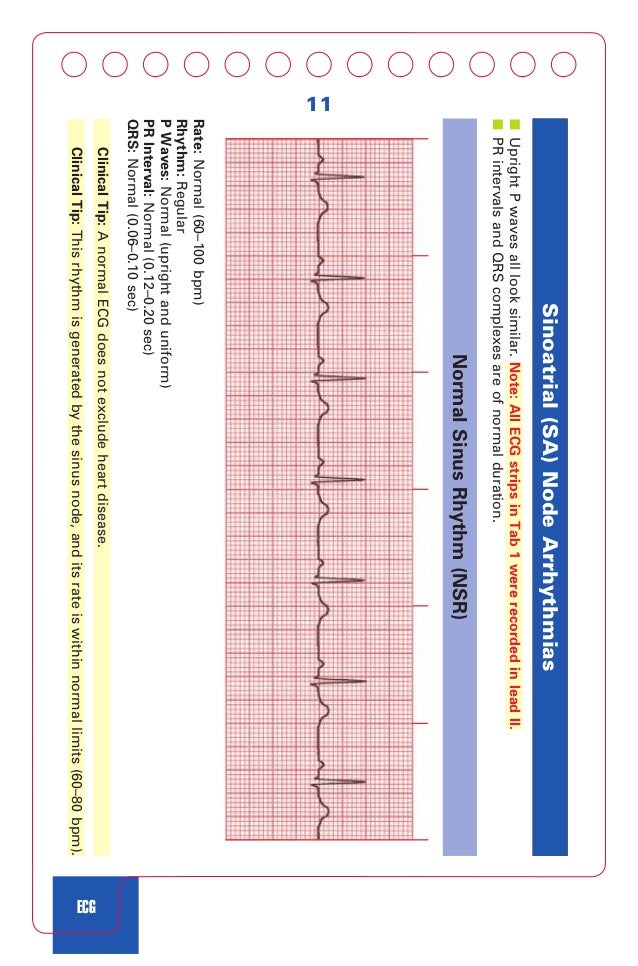 Acls Cpr And Pals Jones Shirley