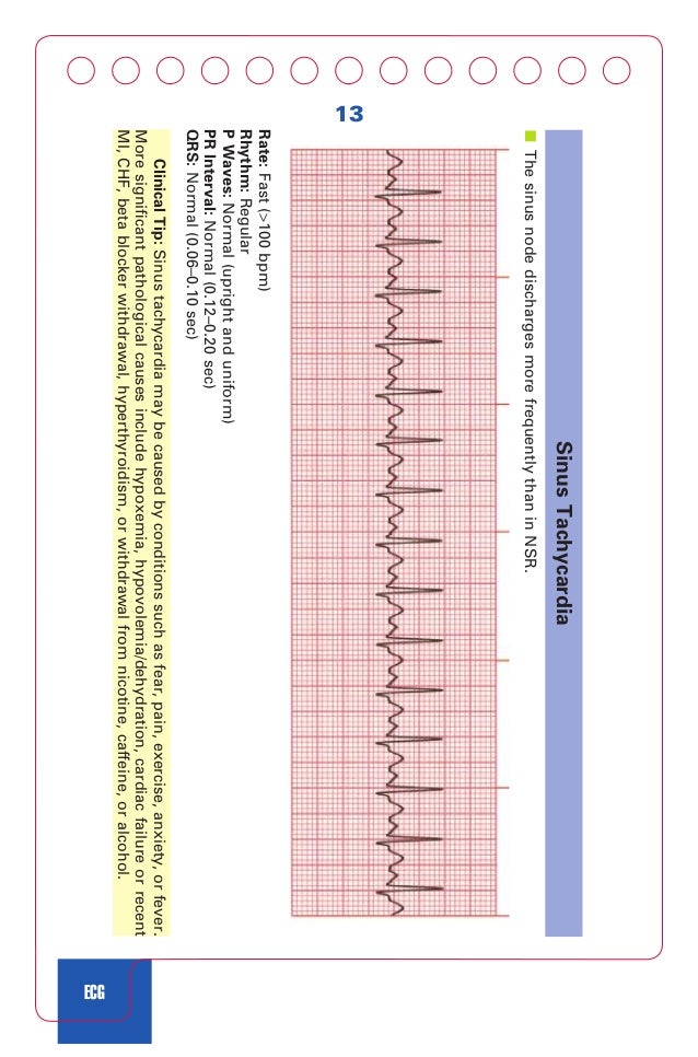 Acls Cpr And Pals Jones Shirley