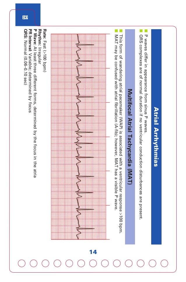 Acls Cpr And Pals Jones Shirley