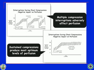 Acls guidelines 2015 | PDF
