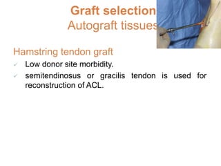 Graft selection
Allograft ligament replacement
 Bone-patellar tendon-bone
 Achilles’ tendon
 Hamstrings
 Quadriceps te...